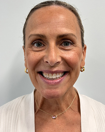 Shelly Gertge Before Face Full-face picture of Shelly before Dr. Cameron began her dental work.