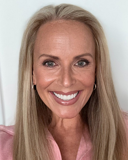 Shelly Gertgen Face After Full-face picture of Shelly after Dr. Cameron completed her dental work.