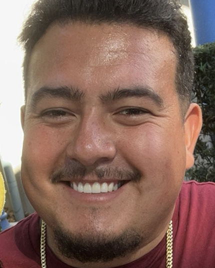 franco-face